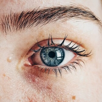 How to treat the skin eyes | Express